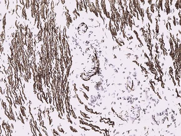 Figure 1. Immunohistochemical detection of desmin in the smooth muscle cells in a paraffin section of the uterus using MUB0401P (clone D9) at a 1:4000 dilution